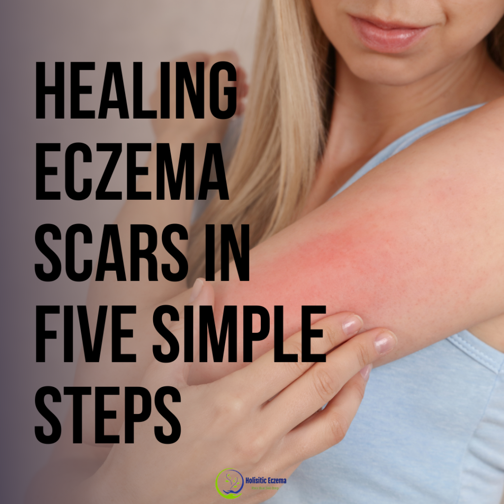 Healing Eczema Scars in 5 simple steps