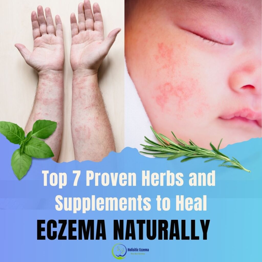 Top 7 Proven Herbs and Supplements for Healing Eczema Naturally - Hands - Baby